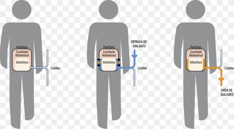 Peritoneal Dialysis Bathroom Public Toilet Male Clip Art, PNG, 1069x591px, Peritoneal Dialysis, Bathroom, Dialysis, Female, Hardware Download Free