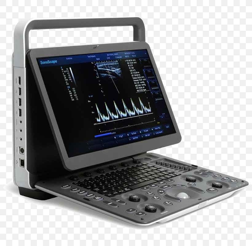 Ultrasonography Portable Ultrasound SonoScape Medical Corp Medical Imaging, PNG, 800x800px, Ultrasonography, Computer Hardware, Display Device, Doppler Fetal Monitor, Doppler Ultrasonography Download Free