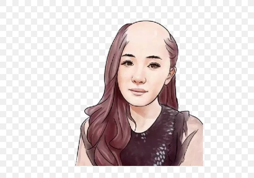 Hair Loss Capelli Shampoo Bangs, PNG, 555x577px, Watercolor, Cartoon, Flower, Frame, Heart Download Free