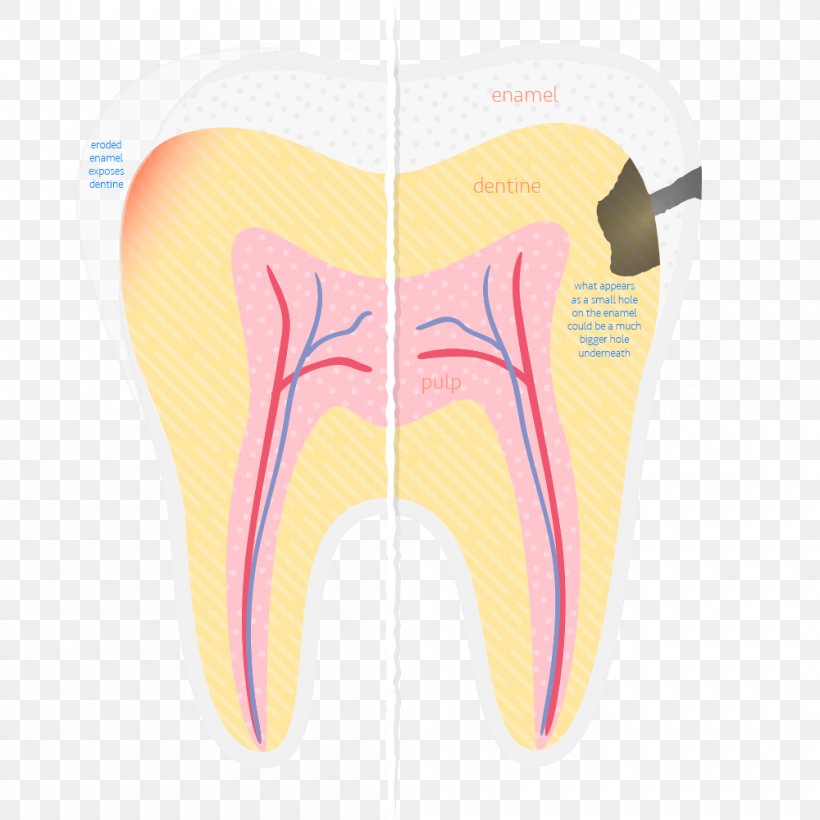 Sports & Energy Drinks Human Tooth Tooth Decay Dentist, PNG, 1000x1000px, Watercolor, Cartoon, Flower, Frame, Heart Download Free
