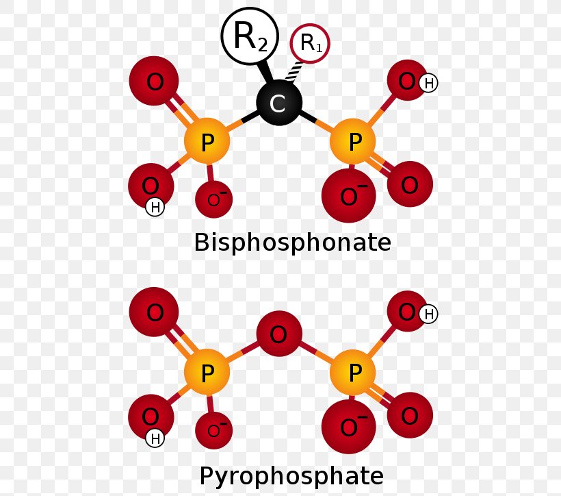 Bisphosphonate Ibandronic Acid Pyrophosphate Pharmaceutical Drug Osteoporosis, PNG, 500x724px, Bisphosphonate, Area, Artwork, Calcification, Hip Fracture Download Free