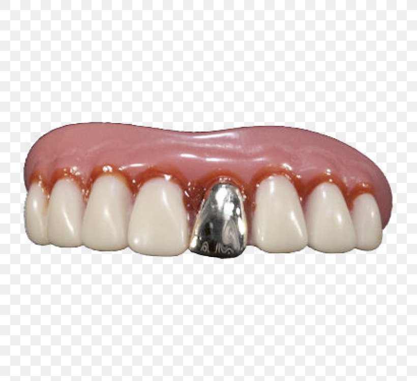 Human Tooth Dentures Gold Teeth, PNG, 750x750px, Tooth, Cosmetic Dentistry, Deciduous Teeth, Dental Braces, Dentures Download Free