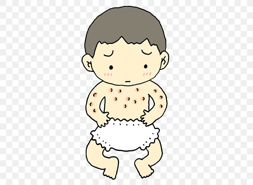 Skin Atopic Dermatitis Allergy Infant No, PNG, 800x600px, Watercolor, Cartoon, Flower, Frame, Heart Download Free