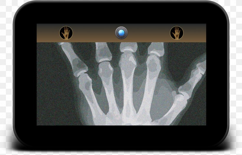 X-ray Military Technology Medical Imaging Renewable Energy, PNG, 1142x730px, Xray, Bowers Wilkins, Con Artist, Finger, Hand Download Free