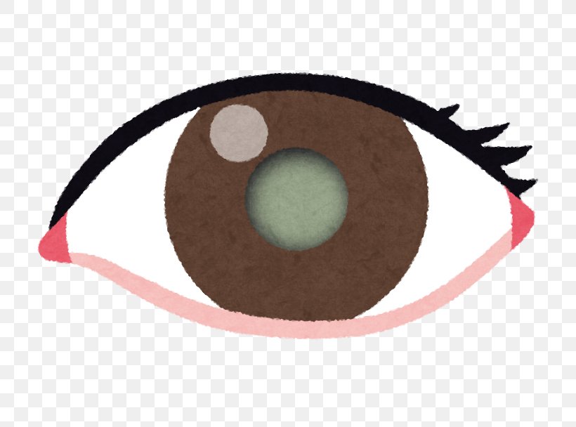 Red Eye Stye Sluggishness Cataract, PNG, 770x608px, Eye, Amblyopia, Cataract, Eye Strain, Eyelid Download Free