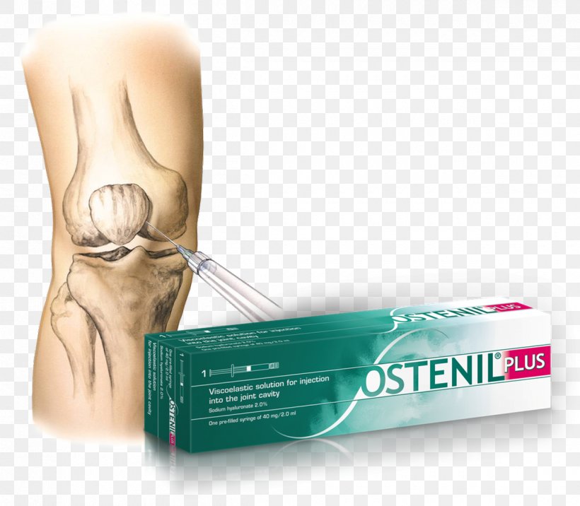 Hyaluronic Acid Osteoarthritis Therapy Joint Injection, PNG, 1200x1049px, Hyaluronic Acid, Brand, Human Musculoskeletal System, Injection, Joint Download Free