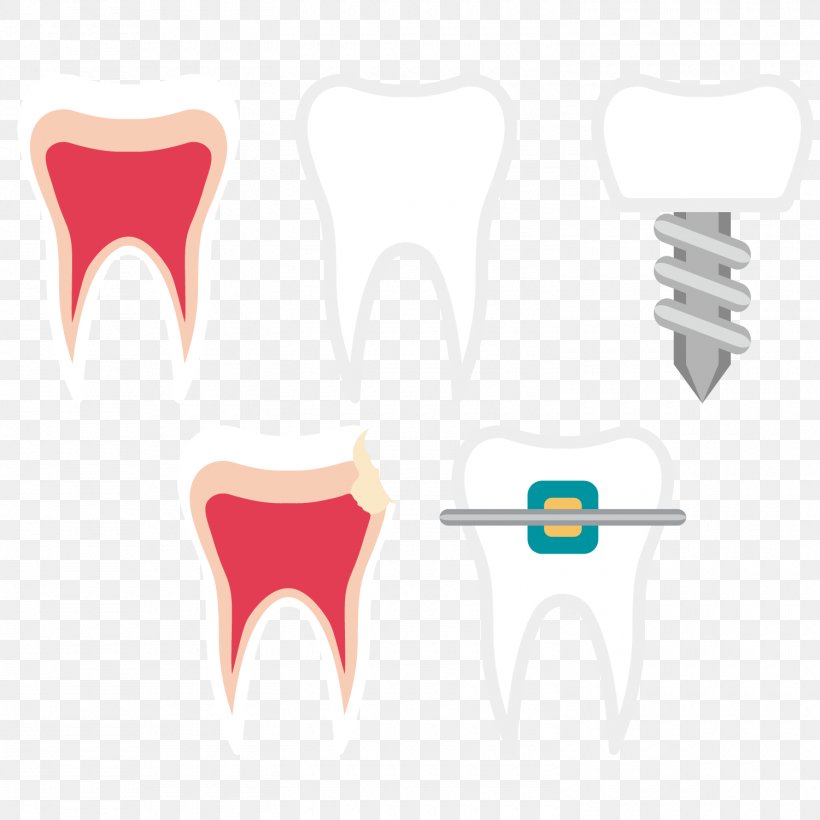 Tooth Dentistry Euclidean Vector, PNG, 1500x1500px, Watercolor, Cartoon, Flower, Frame, Heart Download Free