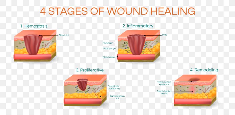 Wound Healing Scar Surgery, PNG, 801x401px, Wound Healing, Acne, Brand, Healing, Hypertrophic Scar Download Free