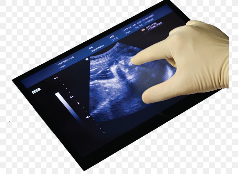 Display Device Touchscreen Capacitive Sensing Human Interface Device User Interface, PNG, 756x600px, Display Device, Capacitive Sensing, Computer Monitors, Electronic Device, Electronics Download Free