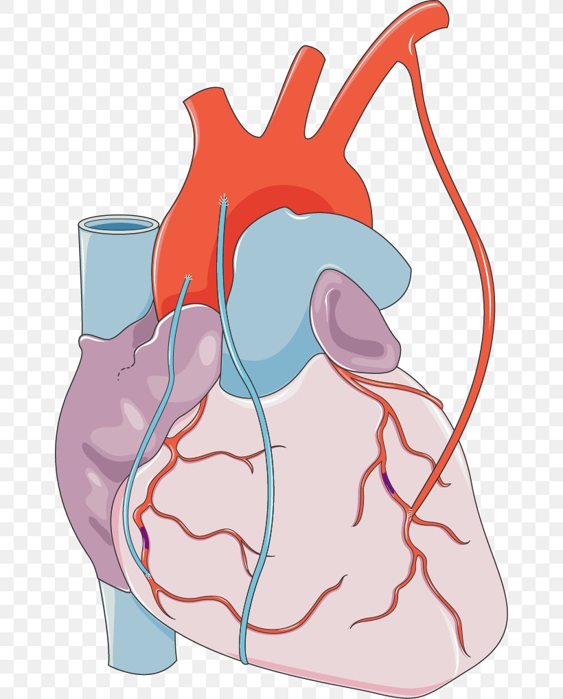 Coronary Artery Bypass Surgery Myocardial Infarction Cardiology Coronary Arteries, PNG, 660x1017px, Watercolor, Cartoon, Flower, Frame, Heart Download Free