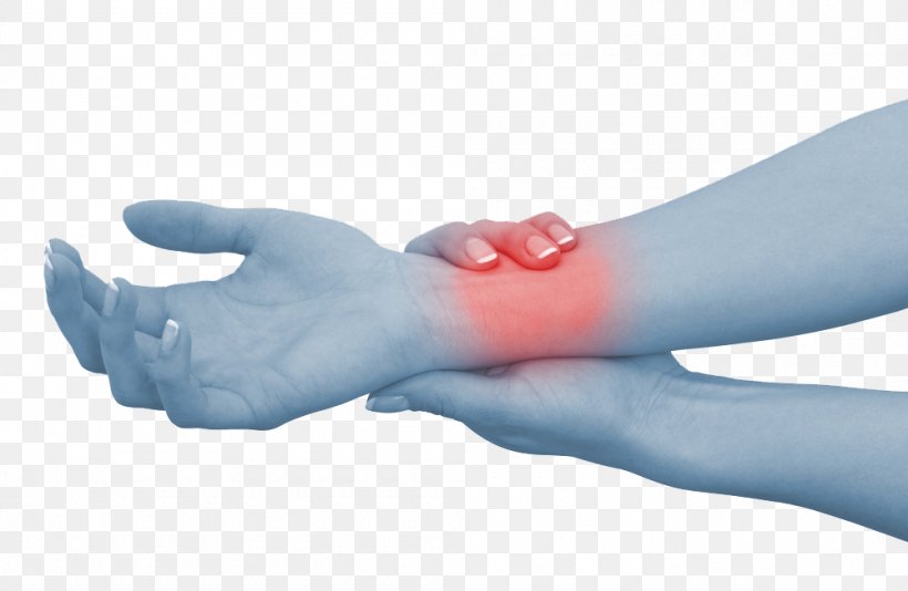 Wrist Pain Hand Carpal Tunnel Syndrome Sprain, PNG, 1000x652px, Wrist Pain, Arm, Carpal Tunnel, Carpal Tunnel Syndrome, Elbow Download Free