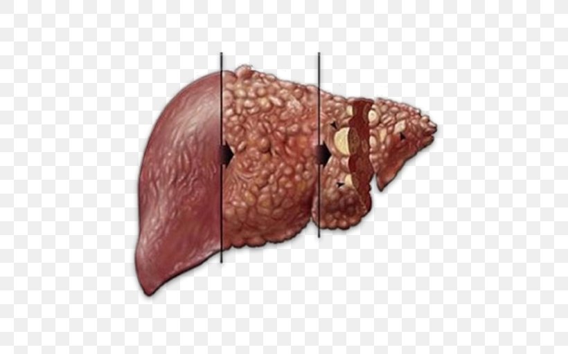 Liver Disease Hepatitis C Infectious Disease, PNG, 512x512px, Watercolor, Cartoon, Flower, Frame, Heart Download Free