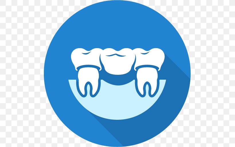 Dentistry Bridge Crown Dental Implant, PNG, 513x513px, Dentist, Area, Blue, Bridge, Cosmetic Dentistry Download Free