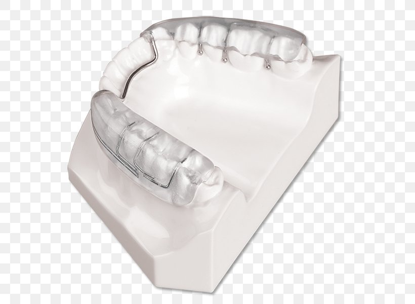 Mouthguard Splint Mandible Tooth Jaw, PNG, 593x600px, Mouthguard, Dorsal Fin, Dynaflex, Hand, Home Appliance Download Free