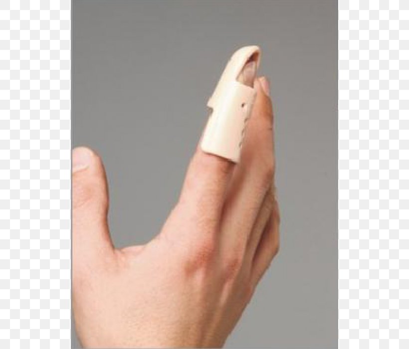 Splint Mallet Finger Hammer Toe Digit, PNG, 700x700px, Splint, Bandage, Calf, Digit, Finger Download Free