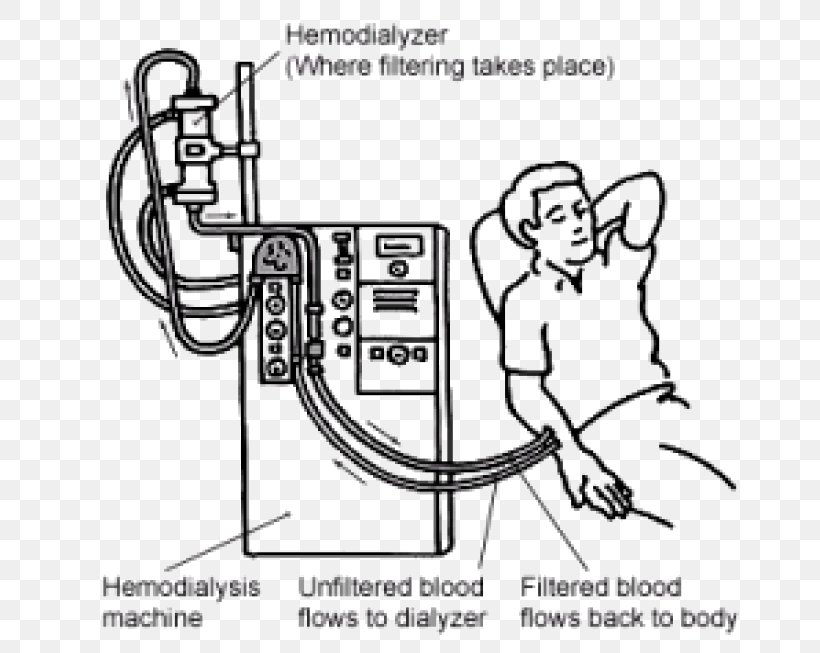 Hemodialysis Kidney Failure Chronic Kidney Disease, PNG, 747x653px, Watercolor, Cartoon, Flower, Frame, Heart Download Free