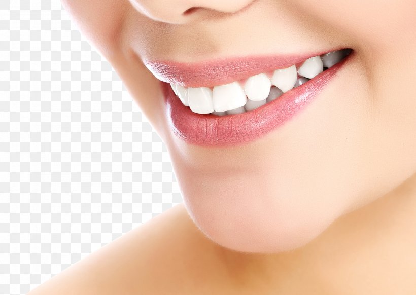 Cosmetic Dentistry Smile Tooth Whitening, PNG, 1900x1350px, Dentistry, Beauty, Cheek, Chin, Close Up Download Free