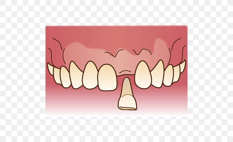 審美歯科 Dentist Dentures Dental Technician, PNG, 500x500px, Watercolor, Cartoon, Flower, Frame, Heart Download Free