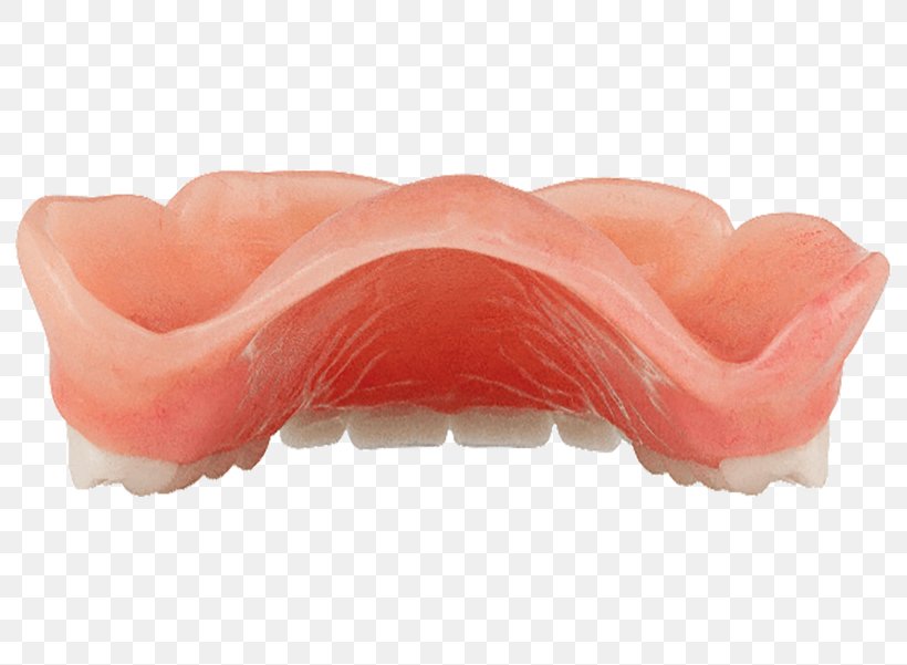 Mouth Dentures, PNG, 800x601px, Mouth, Dentures, Jaw, Peach Download Free