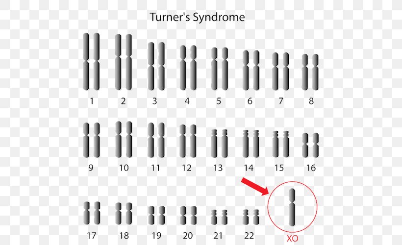 Monosomy Turner Syndrome X Chromosome Triple X Syndrome, PNG, 500x500px, Monosomy, Chromosome, Chromosome Abnormality, Cylinder, Fotolia Download Free