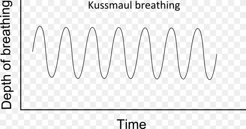 Kussmaul Breathing Kussmaul's Sign Respiration Respiratory System, PNG, 1141x601px, Breathing, Area, Black, Black And White, Brand Download Free