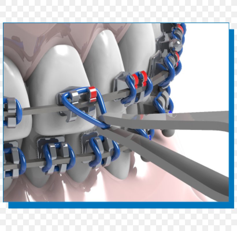 Clínica União Passos Orthodontics Dentistry Dental Braces, PNG, 800x800px, Orthodontics, Blue, Clinica, Dental Braces, Dentistry Download Free