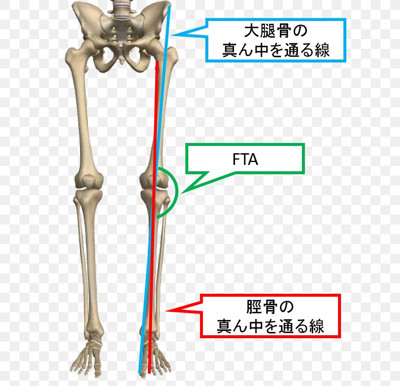 Knee Osteoarthritis Genu Valgum 膝関節 Bone, PNG, 601x791px, Watercolor, Cartoon, Flower, Frame, Heart Download Free