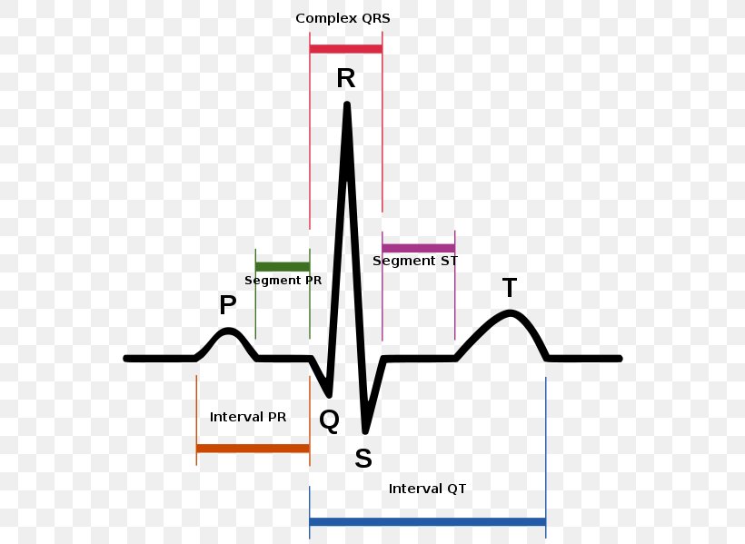 Sinus Rhythm Electrocardiography Heart Rate Sinus Tachycardia, PNG, 557x599px, Sinus Rhythm, Anatomy, Area, Atrial Fibrillation, Cardiac Cycle Download Free