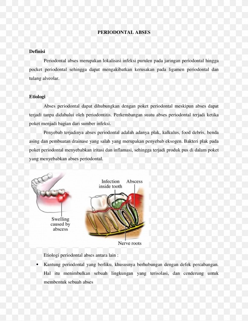 Paper Dental Abscess Font, PNG, 1700x2200px, Paper, Dental Abscess, Diagram, Text, Tooth Download Free