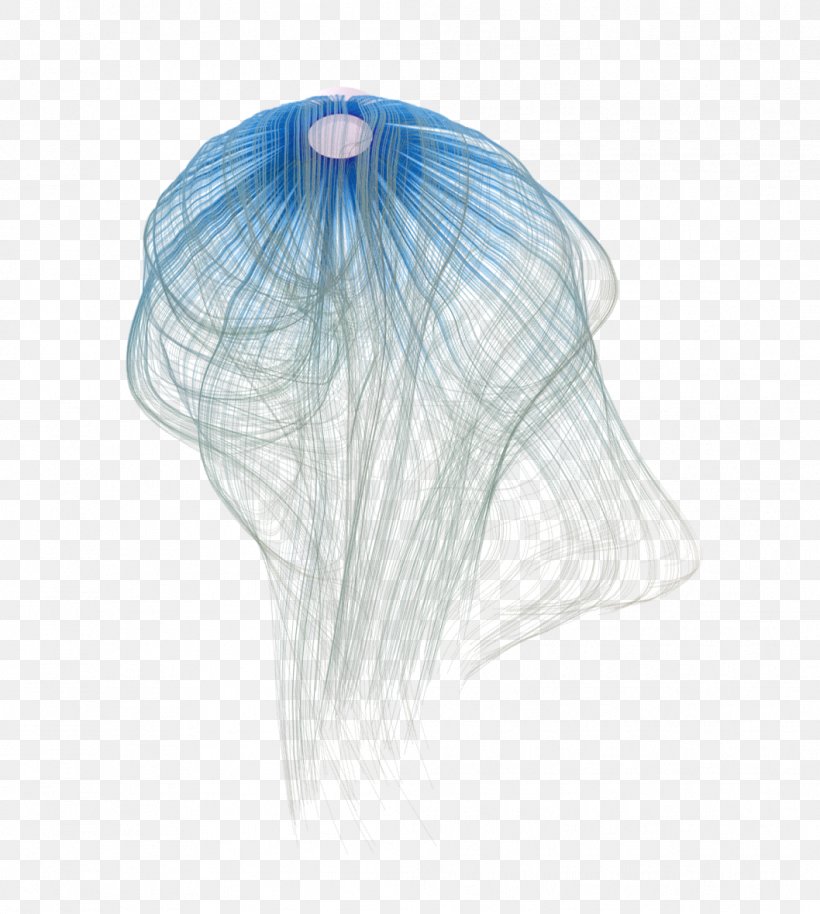 Ventilation Zehnder Heating Radiators Marketing Jellyfish, PNG, 1058x1180px, Ventilation, Blue, Dominance, Hair, Heating Radiators Download Free