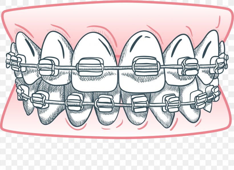 ZSIGMON DENTAL CLINIC Tooth Dentistry Health Care, PNG, 1161x843px, Watercolor, Cartoon, Flower, Frame, Heart Download Free