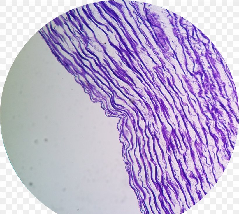 Elastic Fiber Wikimedia Commons Optical Microscope Artery, PNG, 3234x2895px, Elastic Fiber, Artery, Elasticity, Fiber, Microscope Download Free