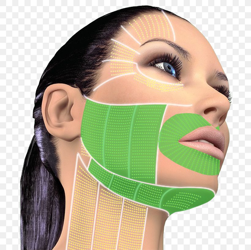 High-intensity Focused Ultrasound Surgery Rhytidectomy Therapy Skin Care, PNG, 728x818px, Highintensity Focused Ultrasound, Cheek, Chin, Face, Facial Hair Download Free