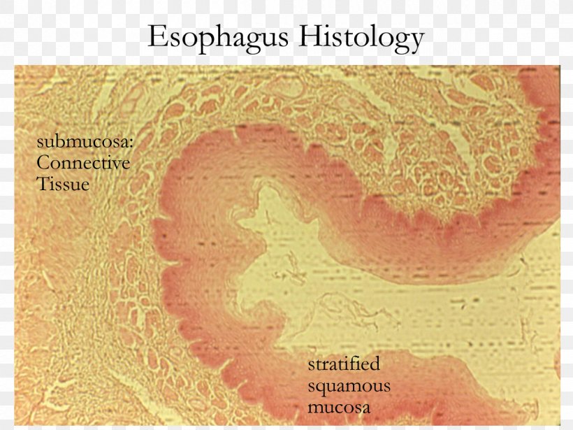 Esophagus Stratified Squamous Epithelium Simple Columnar Epithelium Histology, PNG, 1200x900px, Watercolor, Cartoon, Flower, Frame, Heart Download Free