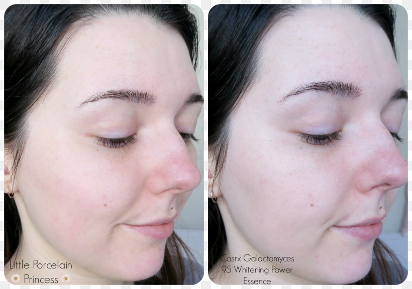 BB Cream Cosmetics Face Eye Shadow Skin, PNG, 1600x1124px, Bb Cream, Cheek, Chin, Cosmetics, Ear Download Free