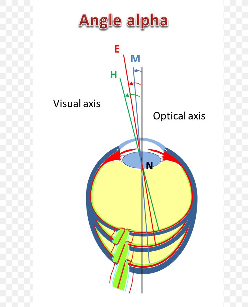 Near-sightedness Eye Far-sightedness Strabismus Angle, PNG, 732x1015px, Nearsightedness, Area, Complication, Diagram, Divergent Series Download Free