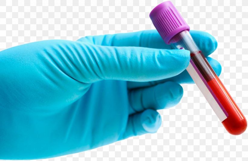 Blood Test Herpes Simplex Virus Herpes Labialis Herpetic Whitlow, PNG, 831x540px, Blood Test, Blood, Brush, Cancer, Diagnostic Test Download Free