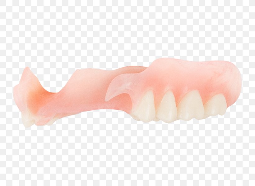 Tooth Dentures, PNG, 749x600px, Tooth, Dentures, Jaw, Lip, Mouth Download Free