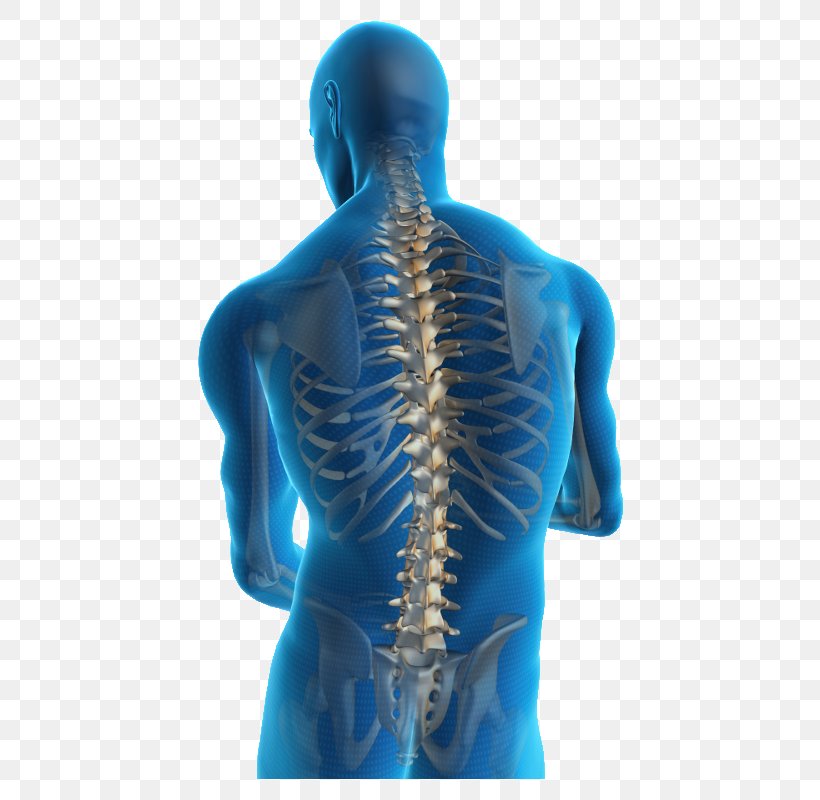 Low Back Pain Neck Pain Back Injury Human Back, PNG, 600x800px, Back Pain, Arm, Back, Back Injury, Electric Blue Download Free