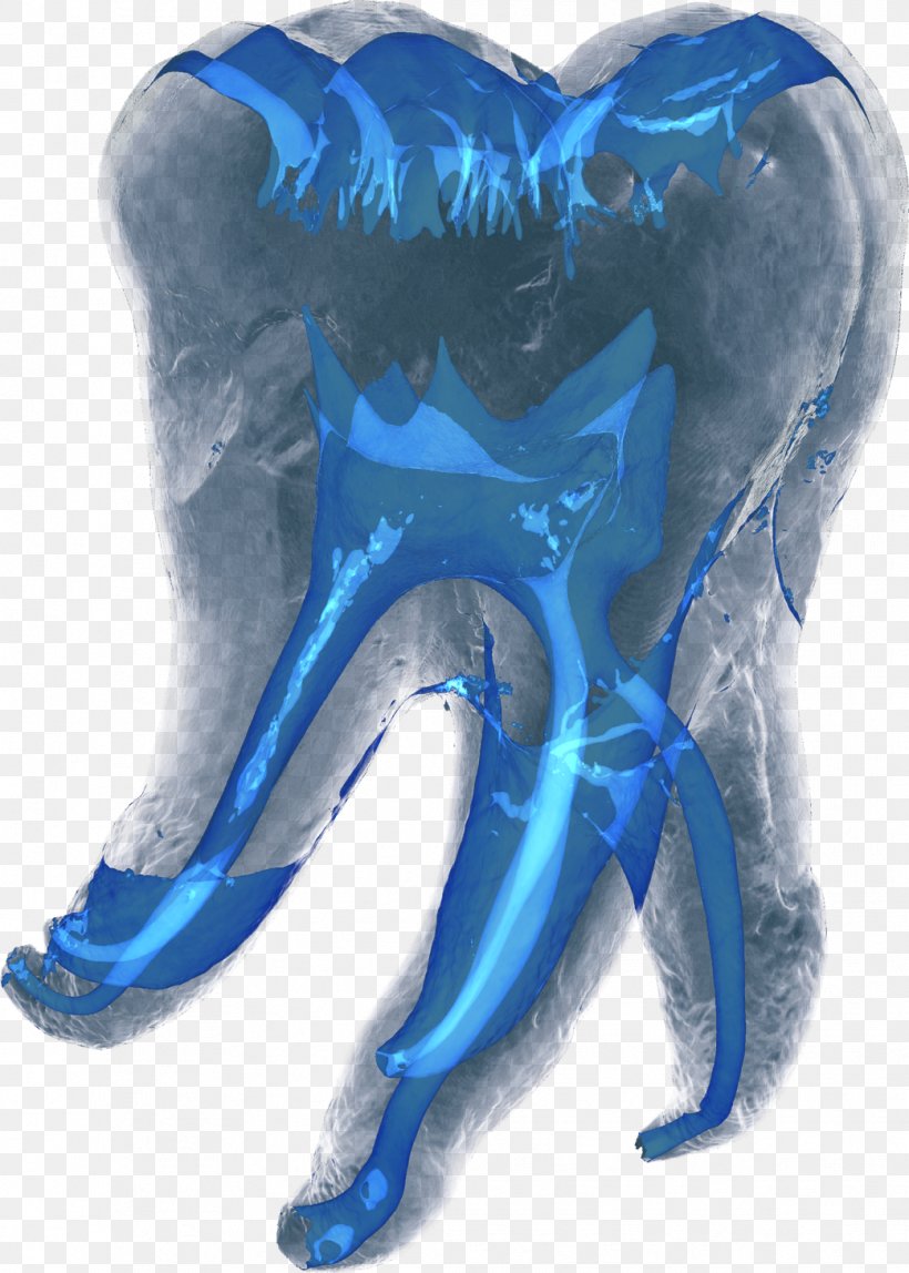 Dentistry Computed Tomography Tooth, PNG, 1042x1460px, Dentistry, Blue, Cobalt Blue, Computed Tomography, Cosmetic Dentistry Download Free