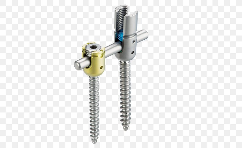 Institute For Composite Materials Ulrich GmbH & Co. KG Implant Vertebral Column Ulrich Medical USA, Inc., PNG, 500x500px, Ulrich Gmbh Co Kg, Cylinder, Hardware, Hardware Accessory, Implant Download Free