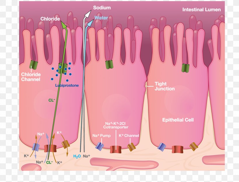 Constipation Lactulose Lactose Intolerance Irritable Bowel Syndrome Symptom Png 1050x800px Constipation Adverse Effect Anorexia Brand Colitis