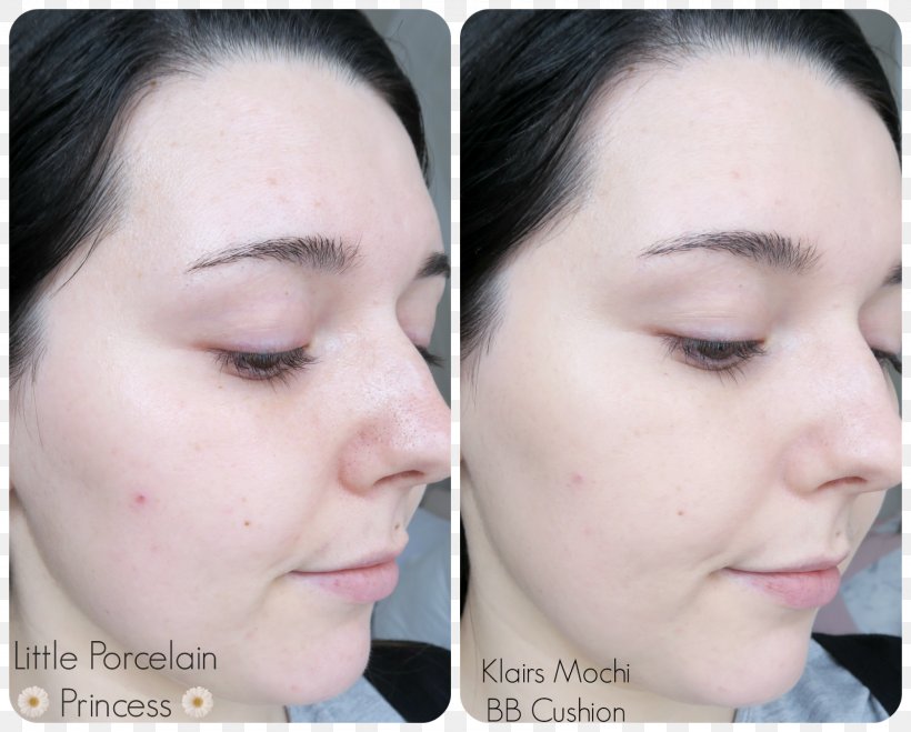 Foundation Human Skin Color Face Powder Lip Balm, PNG, 1600x1286px, Foundation, Bb Cream, Cheek, Chin, Cosmetics Download Free