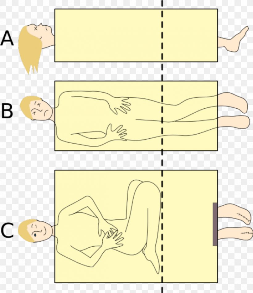 Sawing A Woman In Half Classic Magic Tricks Magician Illusionist, PNG, 1200x1389px, Sawing A Woman In Half, Area, Artwork, Cutting, Diagram Download Free