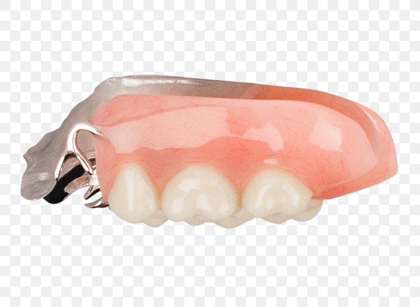 Tooth Dentures, PNG, 749x600px, Tooth, Dentures, Jaw Download Free