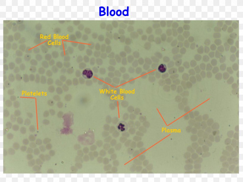 Blood Film Red Blood Cell White Blood Cell, PNG, 1200x900px, Blood Film, Blood, Blood Cell, Blood Plasma, Bone Marrow Download Free