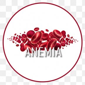 ANEMIA - Dietary Supplement Anemia Iron Supplement Pain Therapy PNG