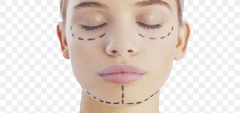 Plastic Surgery La Chirurgie Esthétique Aesthetic Medicine, PNG, 1075x505px, Surgery, Aesthetic Medicine, Aesthetics, Beauty, Botulinum Toxin Download Free