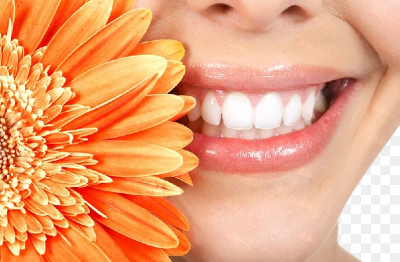 Cosmetic Dentistry Smile Tooth Whitening, PNG, 930x611px, Watercolor, Cartoon, Flower, Frame, Heart Download Free