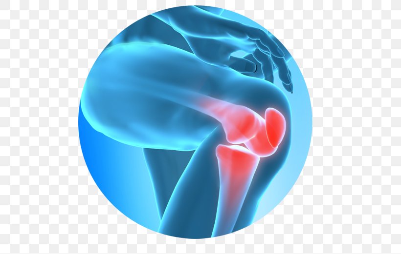 Knee Pain Therapy Pain Management Joint Pain Surgery, PNG, 500x521px, Knee Pain, Ache, Aqua, Arthritis, Blue Download Free